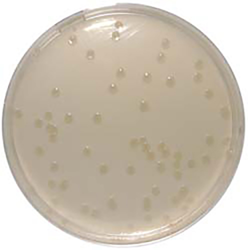 coli NCTC 12241 Blue / green colonies with black centre Enterococcus faecal...